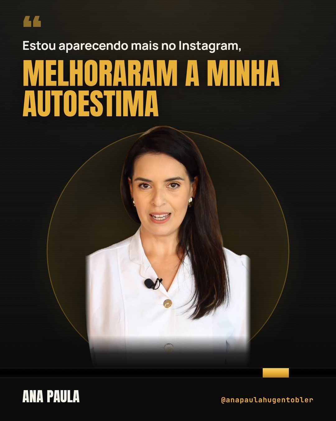 Ana Paula: Estou aparecendo mais no Instagram, melhoraram a minha autoestima